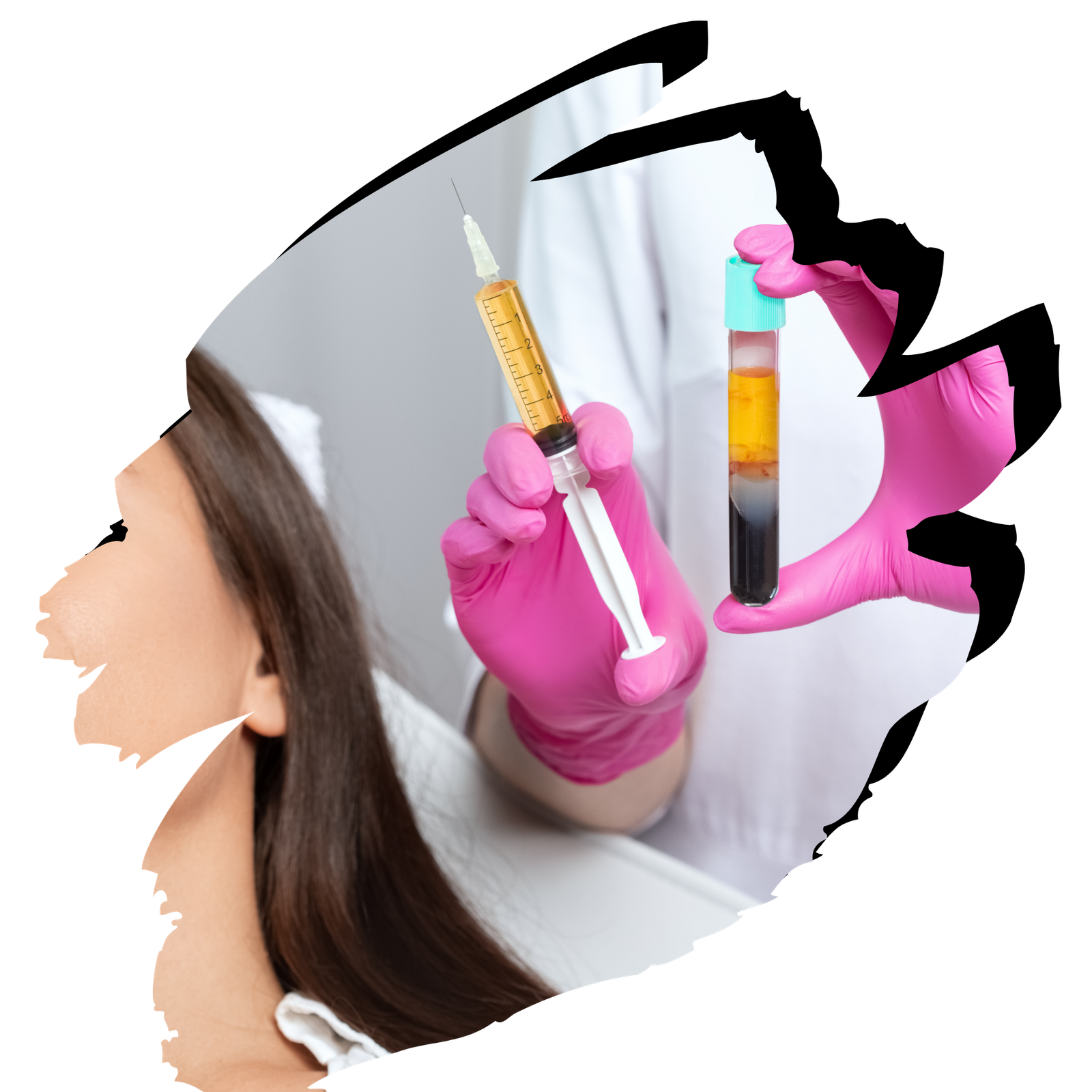 Tubo y jeringa con suero